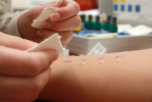 Comprehensive Allergy Care St Louis MO