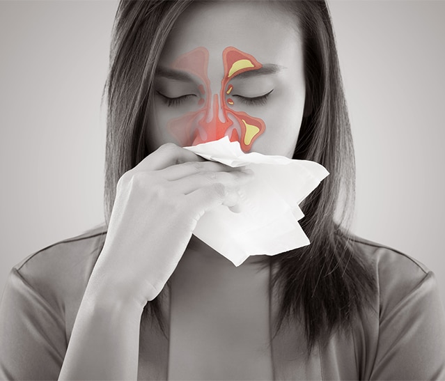 St Louis Sinus Center Allergy Calendar 