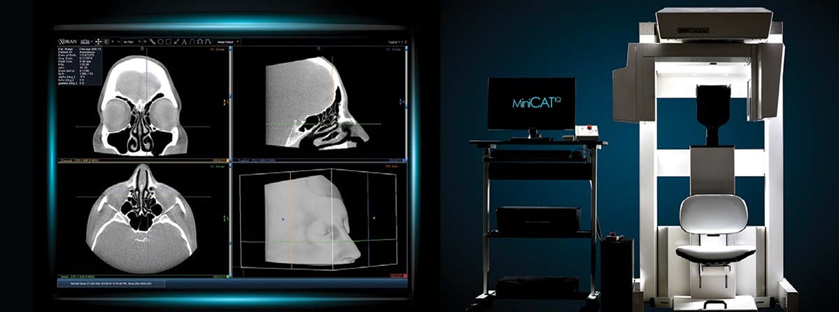 Nasal CT scan taken with the MiniCAT™ Instant CT™ Imaging system