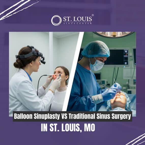 Balloon Sinuplasty vs. Traditional Sinus Surgery at St Louis Sinus Center